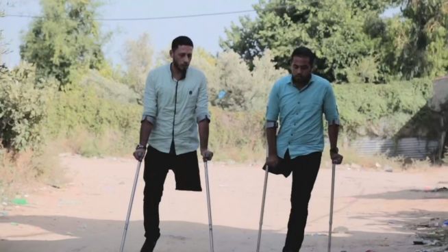 Bombenopfer: Mit einem Bein zu zweit durchs Leben